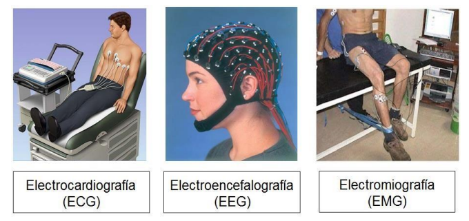 bioelectrodes